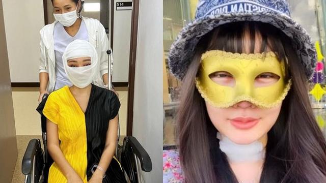 Beda Penampilan 5 Seleb Wanita Tanah Air Jalani Operasi Plastik saat Diperban Vs Setelahnya