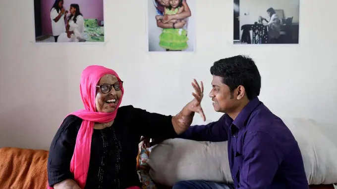 [Bintang] Cerita Mengharukan Korban Siraman Air Keras yang Menemukan Pasangan Hidupnya