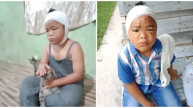 Wajahnya Sering Dicakar, Bocah Ini Tetap Rawat dan Sayang Kucingnya
