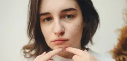 Berbeda dengan jerawat biasa, jerawat hormonal cenderung muncul berulang dan membutuhkan pendekatan perawatan yang konsisten. (Foto/Dok: Pexels)