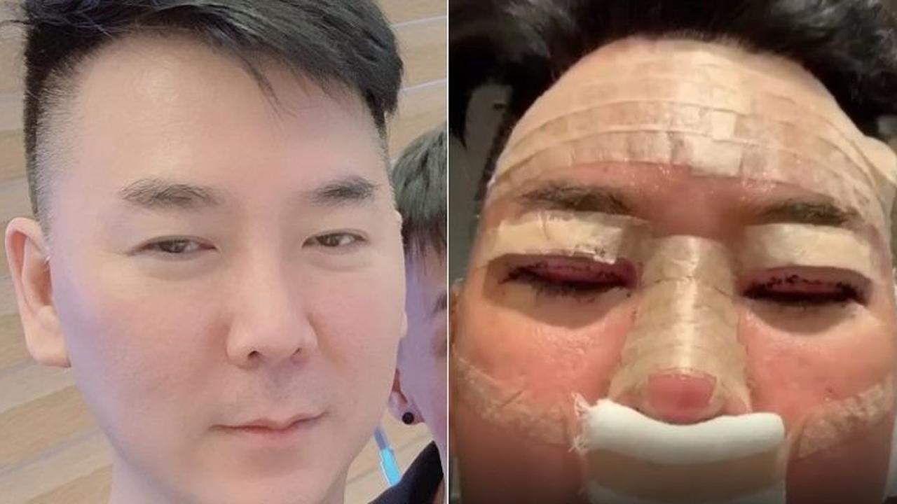 Operasi Plastik Gagal, Pria Ini Ngamuk di Media Sosial