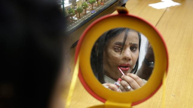 Hari Perempuan Internasional, Korban Siraman Air Keras Jadi Model di India