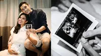 Zivanna Letisha dan suami umumkan anak kedua (kiri). Penampakan si kembar usia 9 minggu (kanan). (Instagram/@zivannaletisha)