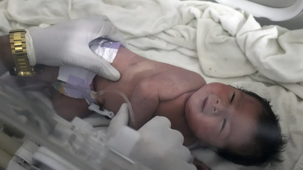 Bayi Baru Lahir Selamat dari Reruntuhan Bangunan Gempa Turki