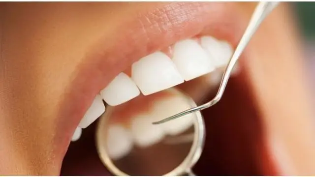 Diabetes sangat berkaitan erat dengan penyakit atau kerusakan jaringan penyangga/penyokong gigi yang secara medis disebut jaringan periodontal, yaitu kerusakan jaringan pendukung gigi yaitu gusi dan di sekitar gigi dan gusi.