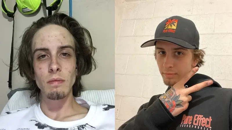 sebelum dan setelah berhenti narkoba