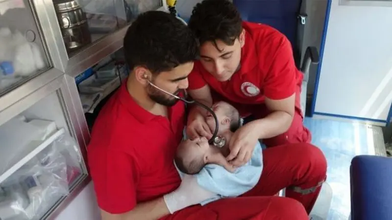 Bayi berkepala dua yang lahir di zona perang Suriah. (Syrian Arab Red Crescent)