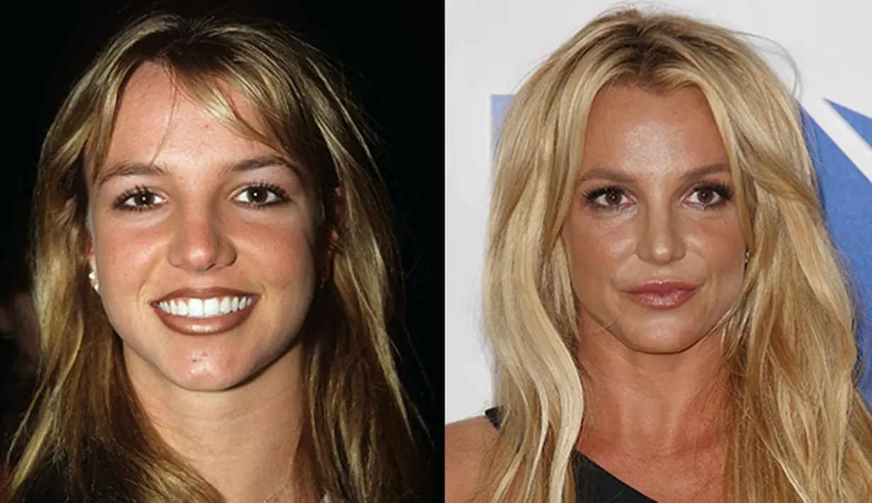 Britney Spears pernah mengaku pada Instyle bahwa dirinya melakukan lip injections. (Rex - Shutterstock - HollywoodLife)