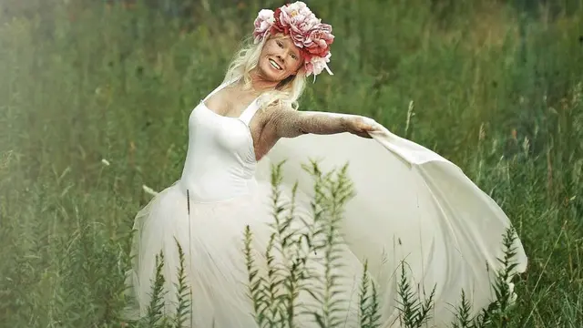 [Bintang] 5 Potret Gadis Bersisik yang Kini Jadi Ratu Kecantikan