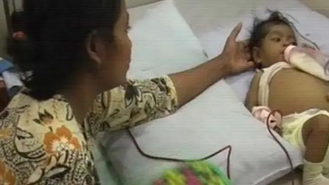 Menderita Kelainan Hati, Perut Dewi Membesar