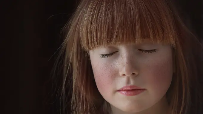 Kulit Wajah Kemerahan