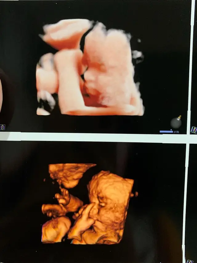 Foto USG calon bayi Vanessa Angel (https://www.instagram.com/p/B_rRITulRtr/)
