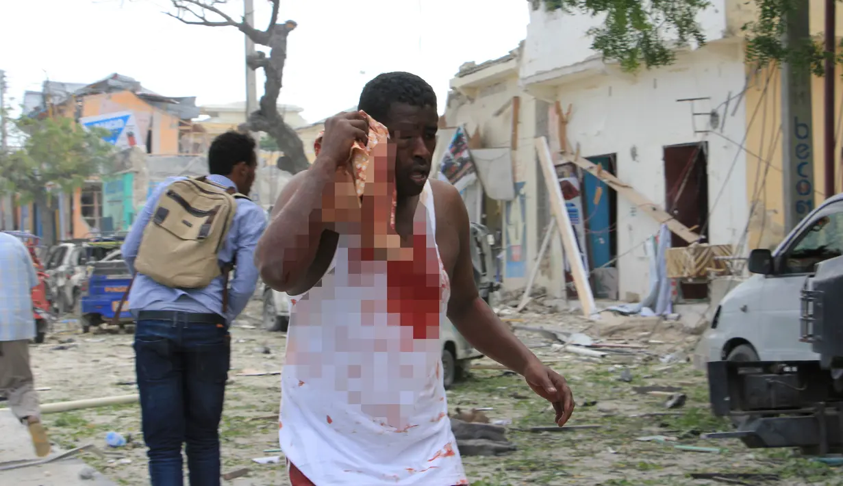 Seorang pria terluka akibat serangan bom mobil yang dilancarkan kelompok Alshabaab kepada sebuah hotel di di Mogadishu, Somalia, Rabu (25/1). Setidaknya 13 orang dilaporkan tewas dan puluhan lainnya terluka dalam kejadian ini. (AP Photo)