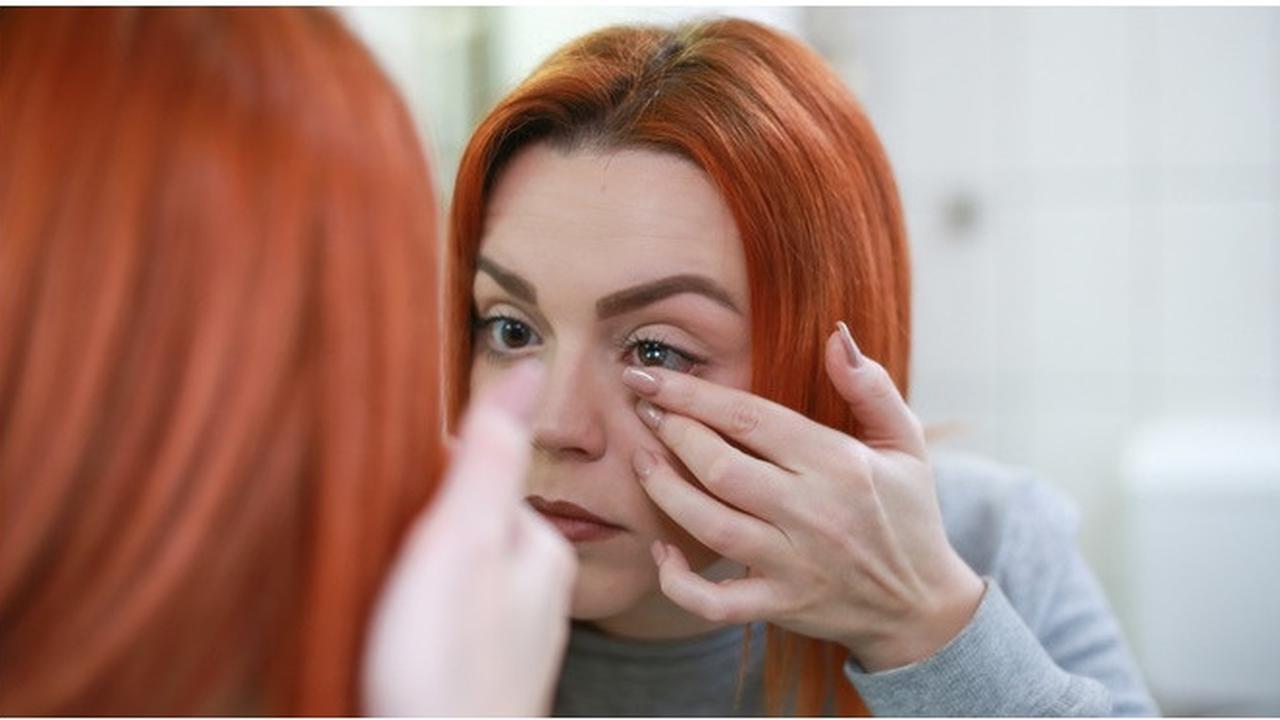 Sering Lupa Dilepas, Dokter Temukan 23 Lensa Kontak Tersangkut di Mata Wanita Ini