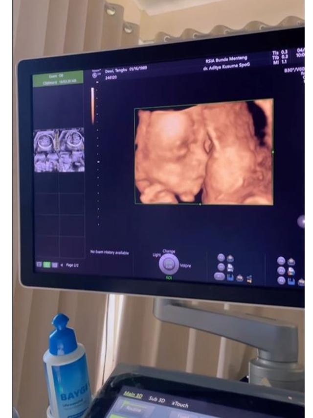 Dituding Selingkuh, Ini 6 Potret Andrew Andika saat Temani Istri Periksa Kandungan