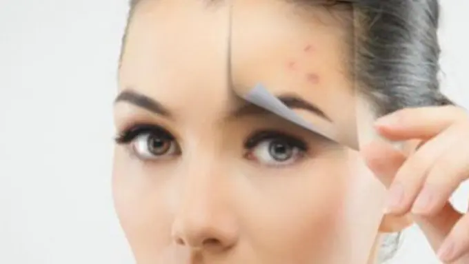 Foto ilustrasi (scarsandspots)