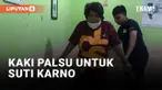 Suti Karno Gunakan Kaki Palsu Usai Diamputasi