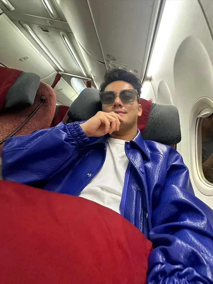 Boy William mengaku lakukan operasi hidung (Instagram/boywilliam17)