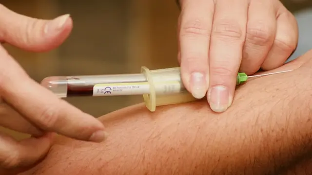 Dapat Membantu Menurunkan Kadar Kolesterol Pada Tubuh