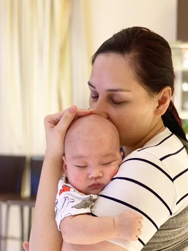 7 Potret Perjuangan Mona Ratuliu Rawat Anak yang Idap Dermatitis Atopik