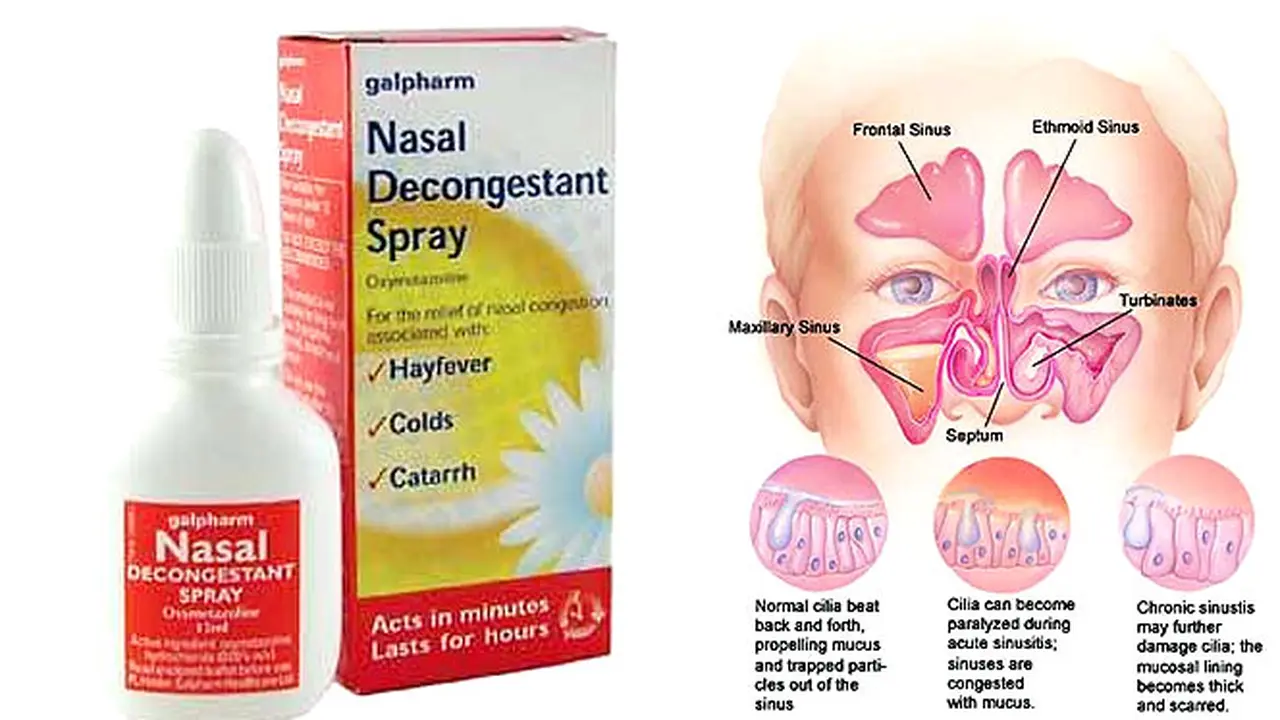 nassal121030b.jpg