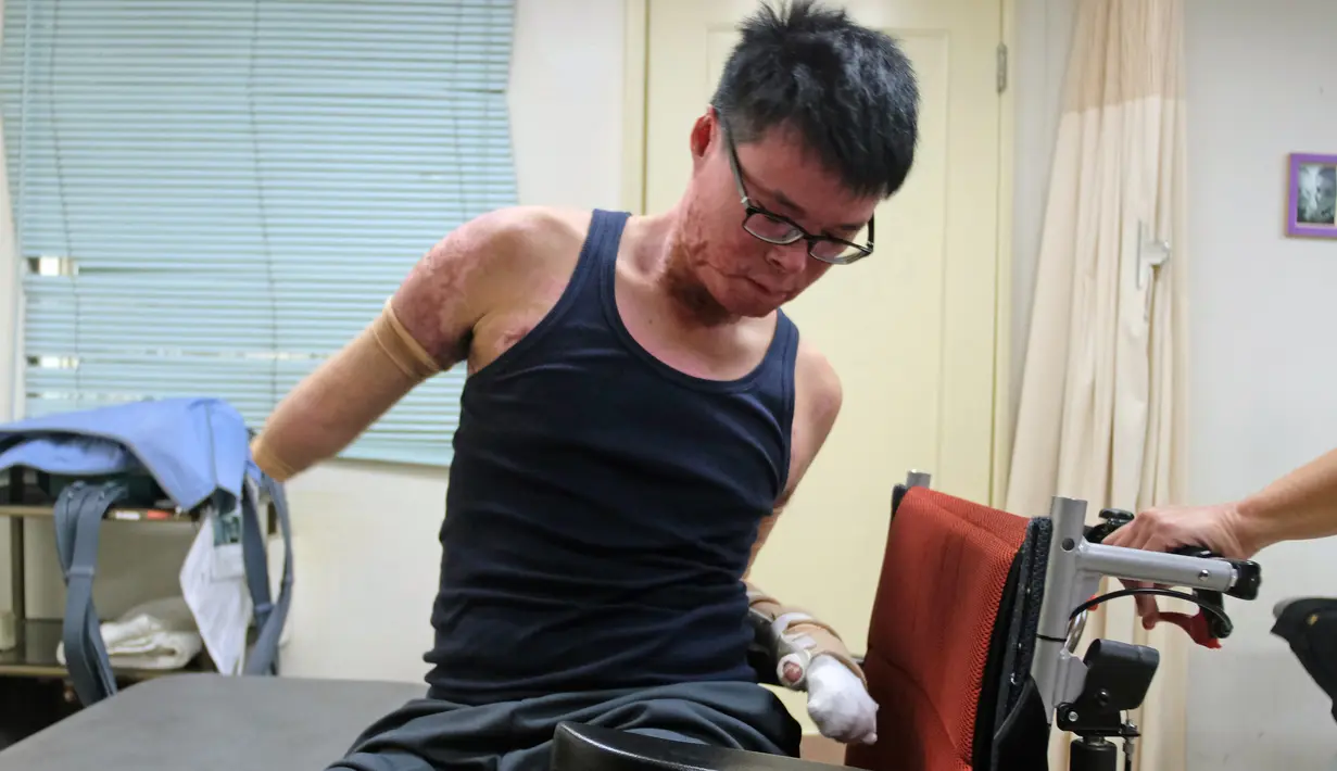 Huang Po - wei saat melakukan sesi rehabilitasi di pusat pemulihan di Taipe, Taiwan, (26/1/2016).Pria 23 tahun ini harus merelakan kaki dan tangannya di amputasi agar terhindar dari infeksi lukanya saat terjadi ledakan tersebut.(SAM YEH / AFP)