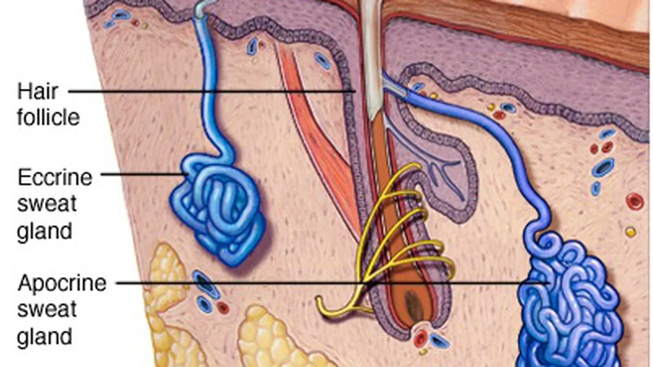 Hiperhidrosis