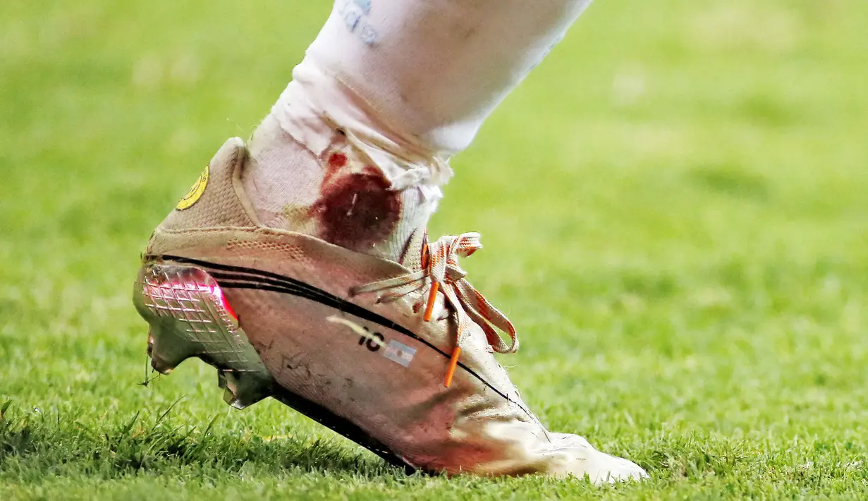 Kaki megabintang Argentina, Lionel Messi, tampak berdarah usai mendapat tekel keras dari bek Kolombia pada laga semifinal Copa America 2021. Meski dalam kondisi cedera ia tetap berjuang dan hingga akhir laga. (Foto:AFP/Silvio Avila)