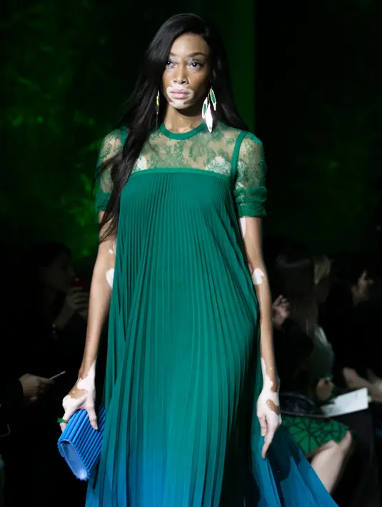 Winnie Harlow berjalan di catwalk mengenakan koleksi Spring/Summer 2018 Elie Saab selama Paris Fashion Week, Minggu (1/10). Winnie terkenal setelah berhasil masuk ke ajang pencarian bakat di AS, America’s Next Top Model (ANTM). (AP Photo/Kamil Zihnioglu)