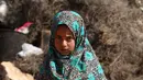 Maya Mohammad Ali Merhi (8) berjalan menggunakan kaki prostetik dari kaleng di sebuah kamp orang terlantar di Provinsi Idlib, Suriah, Rabu (20/6). Alat itu dipakai lantaran sang ayah tidak mampu membelikan kaki palsu yang sebenarnya. (Aaref Watad/AFP)