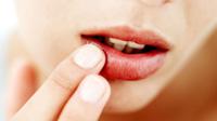 Dengan beberapa cara sederhana ini kamu bisa mengatasi bibir pecah-pecah yang buat penampilan kamu tidak maksimal.
