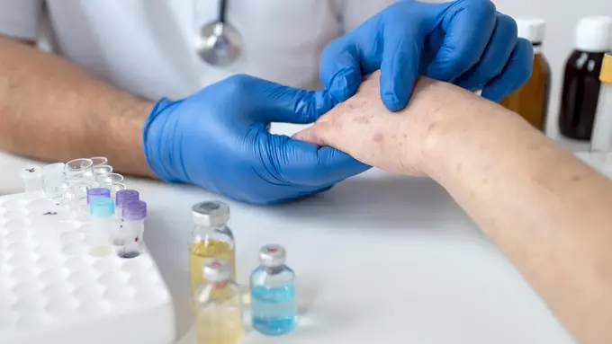 Seorang dokter sedang memeriksa kulit tangan pasiennya (Foto Dok: Freepik/freepik)