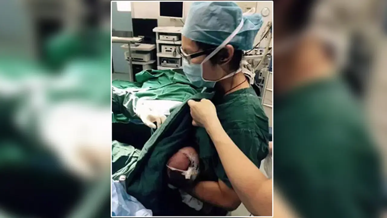 Bayi Ini Disusui Perawat Sebelum Dioperasi
