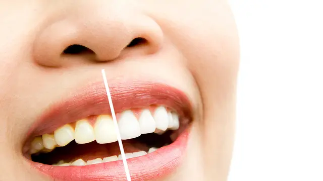 Teeth