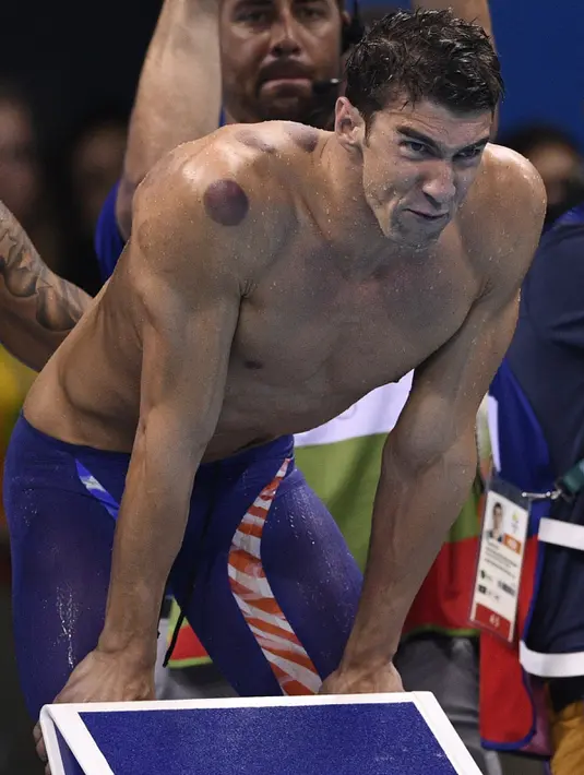 Bekas bekam di pundak kanan perenang AS, Michael Phelps, selama Olimpiade Rio 2016 di Rio de Janeiro, Minggu (7/8). Terapi bekam menjadi cukup populer di kalangan atlet di Olimpiade 2016, termasuk pula di antara kontingen AS. (AFP PHOTO/Martin BUREAU)
