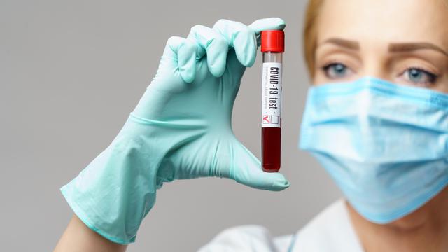 Rapid Test Antigen Covid 19 Pertama Kali Dipakai Di Kabupaten Musi Banyuasin Regional Liputan6 Com