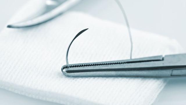 Benang Jahit Luka (Sumber: Bobo.grid.id)