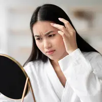 Ilustrasi perempuan cantik dengan kondisi wajah yang sedang breakout. (depositphotos.com/Milkos)
