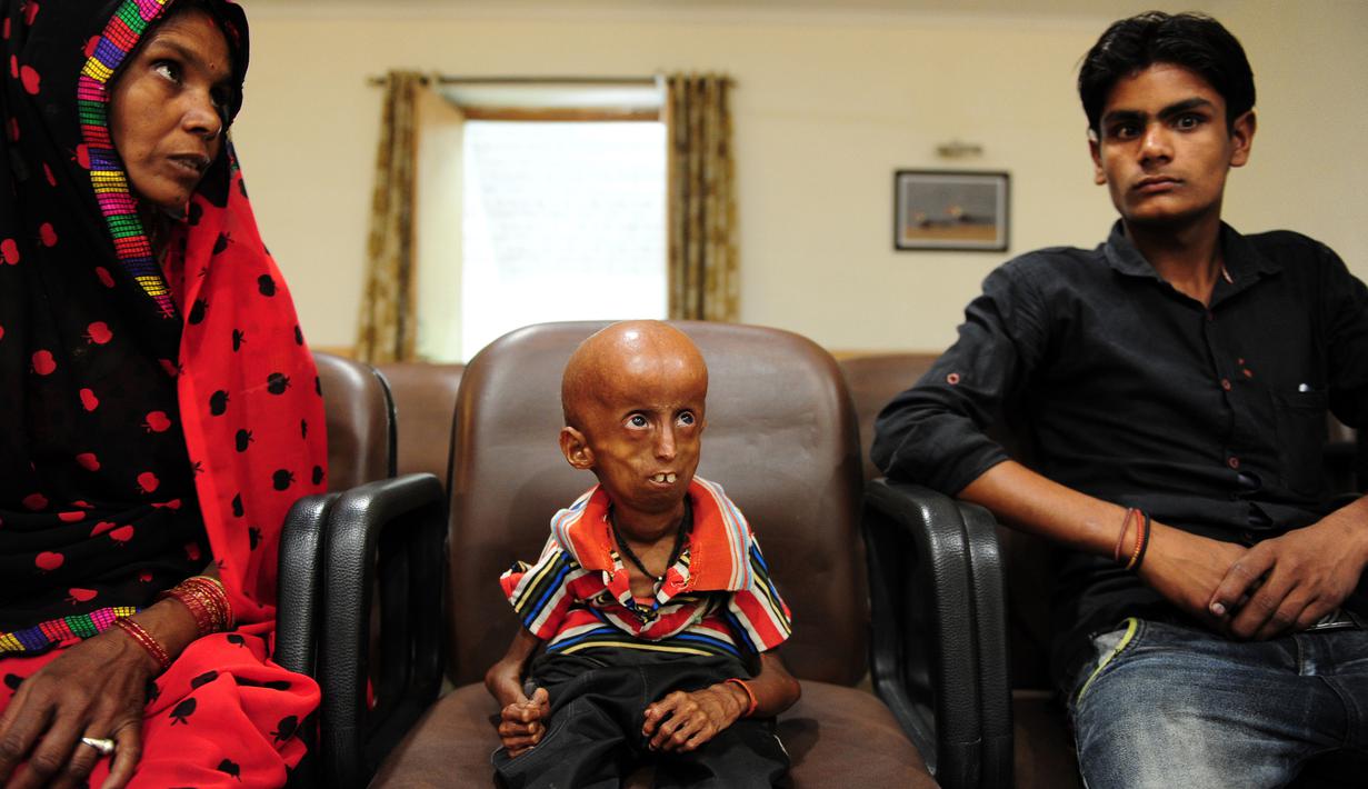 Rupesh Kumar (tengah) bersama ibu dan adiknya di Kantor Magistrat Allahabad, India, Selasa (2/5). Pria 21 tahun itu menderita penyakit penuaan langka progeria Hutchinson-Gilford yang hanya terjadi pada 1 dari 8 juta orang di dunia. (SANJAY KANOJIA / AFP)