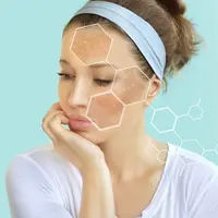 Ilustrasi hiperpigmentasi/Shutterstock-LADO.