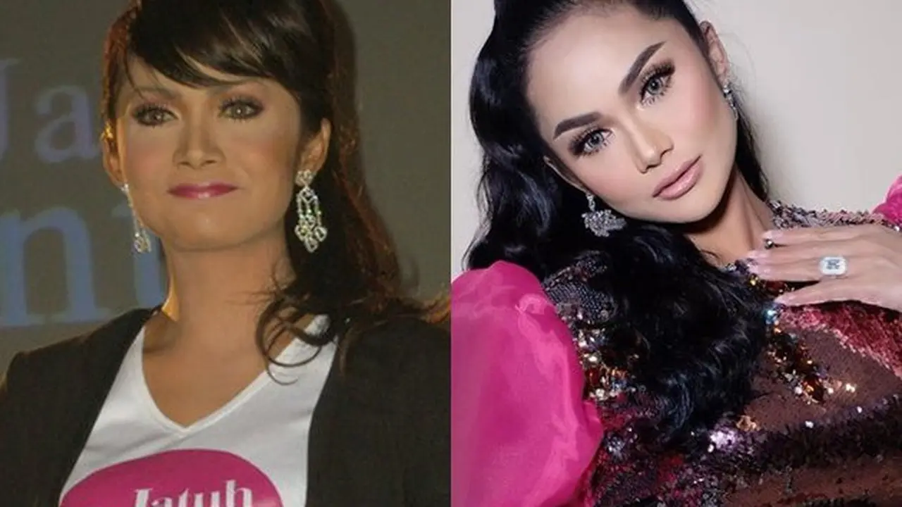 Potret Dulu Vs Kini Penyanyi Diduga Wajahnya Operasi Plastik, Perubahannya Drastis
