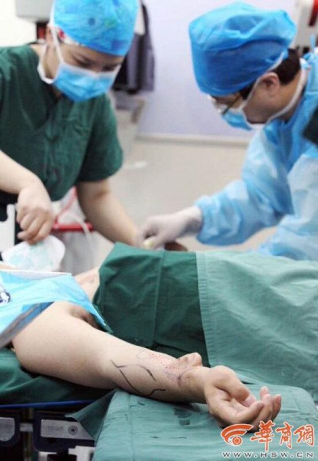 Operasi menumbuhkan telinga di lakukan di tangan pasien | Photo: Copyright shanghaiist.com