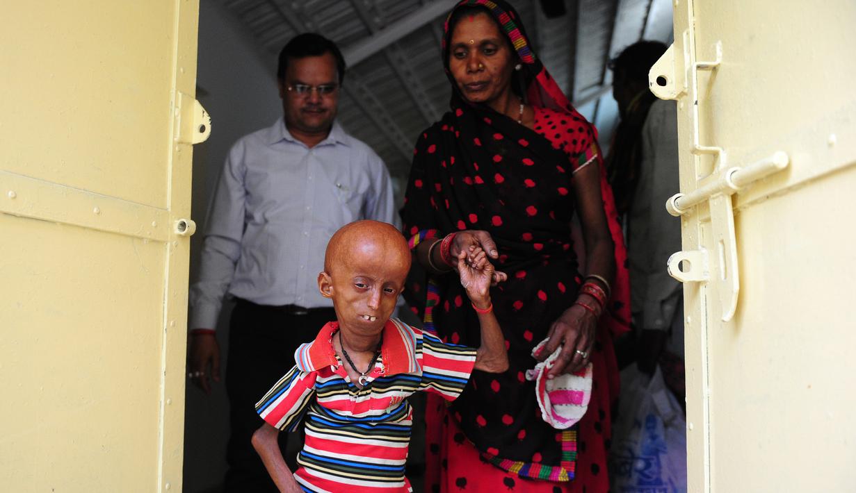 Penyintas progeria, Rupesh Kumar (21) mencari bantuan dana untuk penyakitnya di Kantor Magistrat Allahabad, India, Selasa (2/5). Penyakit langka itu mengubah Rupesh Kumar hingga memiliki wajah seorang kakek berusia 160 tahun. (SANJAY KANOJIA / AFP)