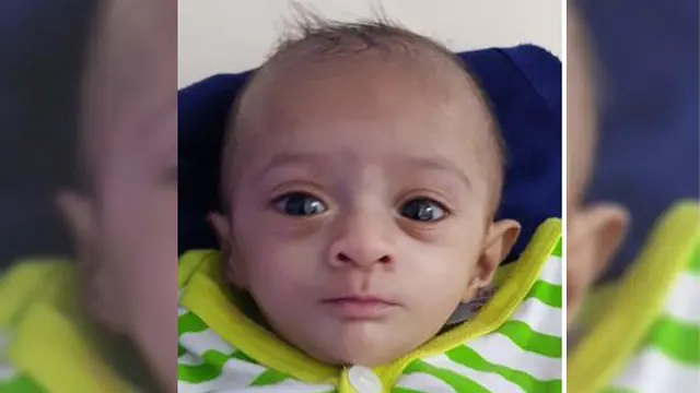 Miliki Berat 400 Gram, Bayi Mungil Ini Mampu Bertahan Hidup