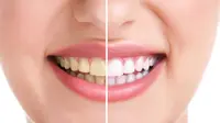 Selain minum kafein, mengonsumsi sejumlah obat juga bisa membuat gigi kuning. Maka itu membuat gigi putih tak cukup dengan pasta gigi.