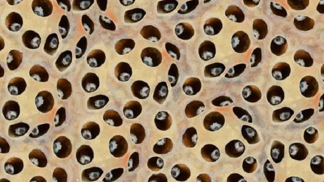 Penyebab Trypophobia