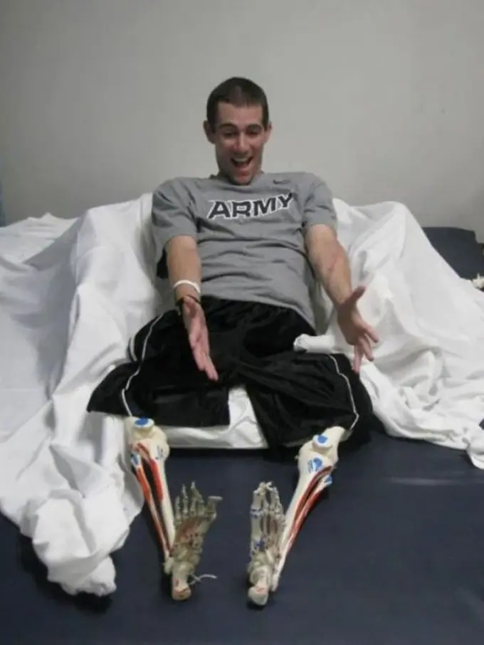 [Bintang] 10 Lelucon dari Orang-orang Cacat yang Kuat