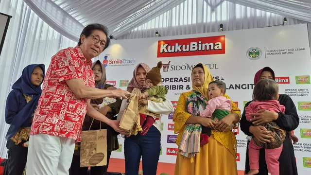 Ringankan Beban Orang Tua, Sido Muncul Berikan Operasi Bibir Sumbing Gratis untuk 40 Pasien di Lebak Banten