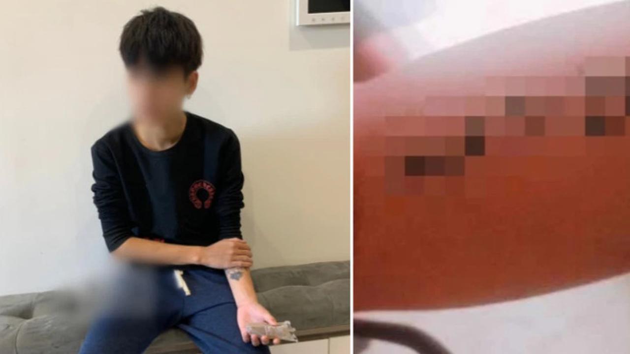 Bikin Tato Nama Pacar, Pria Ini Justru Diputuskan Seminggu Kemudian