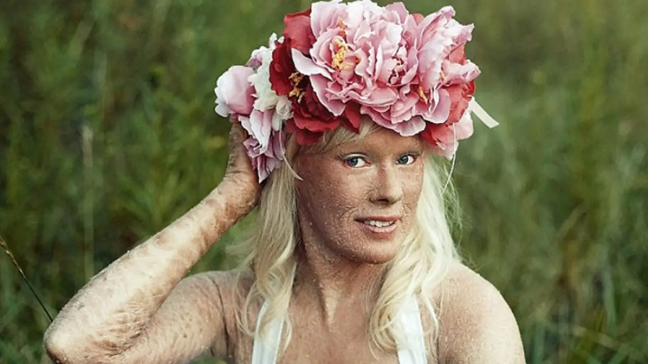 Wanita Berisisik